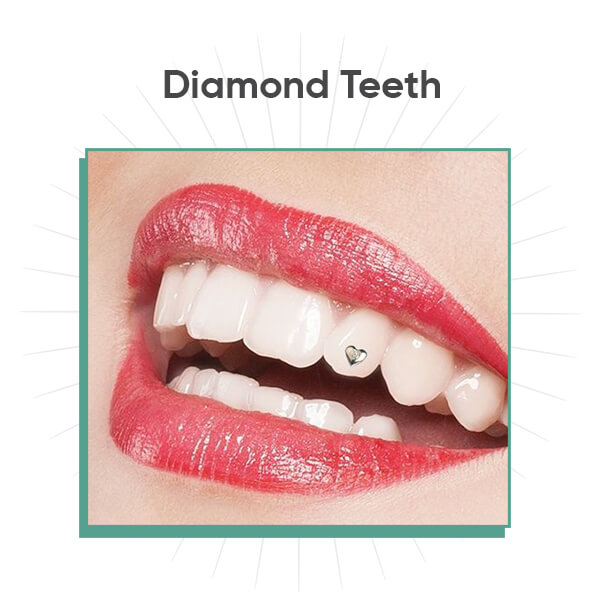 Diamond Teeth