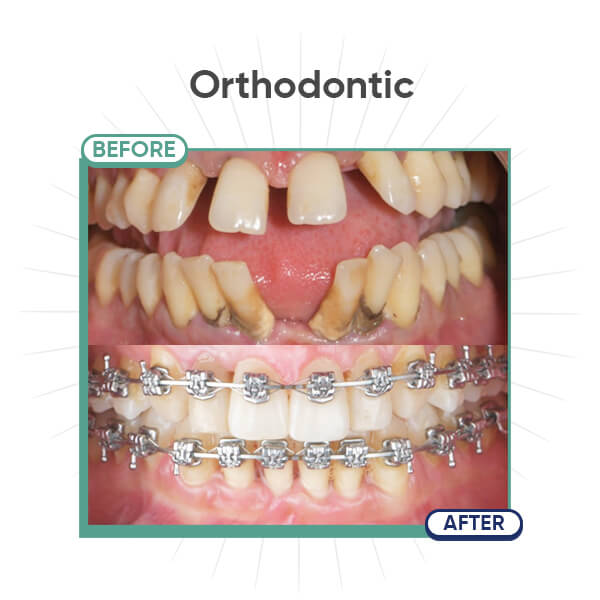 Orthodontic